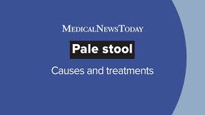 Image result for acholic stools human