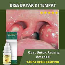 Tonsilitis akut adalah radang akut yang disebabkan oleh kuman streptococcus β hemolyticus, treptococcus viridans dan streptococcus pyogenes, dapat juga. Propolis Brazil Sm Obat Atasi Penyakit Radang Amandel Sakit Tenggorokan Sulit Menelan Amandel Akut Amandel Kronis Radang Tenggorokan Tonsilitis Kronis Tonsilitis Akut Amandel Bengkak Amandel Bernanah Bergaransi Lazada Indonesia