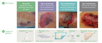Image result for Skin Tear