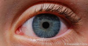Uveitis Symptome Ursachen Therapie Prognose Netdoktor