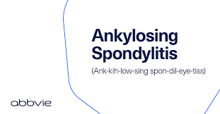 Find, submit and requests pronunciations. Abbvie Us On Twitter Ankylosingspondylitis Is Not Only Difficult To Pronounce But Can Also Be Difficult To Diagnose Help Us Spread The Word About This Chronic Inflammatory Disease This Worldasday On May