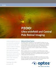 The device allows for the discovery of retinal melanomas and. P200 Brochure Optos