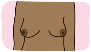 It will also lose the lima bean shape and become more rounded like a marble. Breast Cancer Symptoms Breast Cancer Now