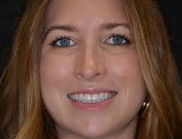 Smile Gallery-Tallahassee FL