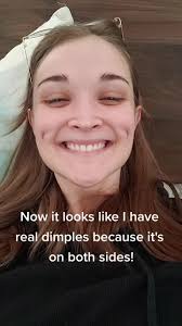 I know this filter is supposed to make you feel bad about yourself but how  cute is this #asymmetricalface #asymmetrical #loveyourself#selflove#cute  #smile#dimples