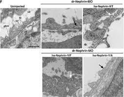 The following points highlight the seven important components of bacterial cell. The Human Nephrin Y1139rsl Motif Is Essential For Podocyte Foot Process Organization And Slit Diaphragm Formation During Glomerular Development Journal Of Biological Chemistry