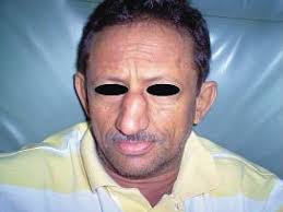 RBReumatologia PARTE 2.indd