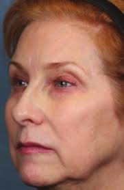 Impact of Comprehensive, Minimally Invasive, Multimodal Aesthetic Treatment 