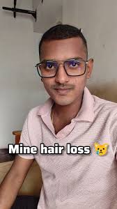 நானும் feel பண்ணி இருக்கேன்😳😖😱😩.... #hairlose#pain#stress#marege  Creator :Daniel Rook ..🙂 Follow me : @crazytalksofficial ❤Thank you for  watching❤