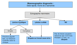 Zone dure à la palpation au niveau du sein. 2 Quand Faut Il Soupconner Cliniquement Un Cancer Du Sein Palli Science Site Officiel De Formation En Soins Palliatifs Et Oncologie De 1ere Ligne
