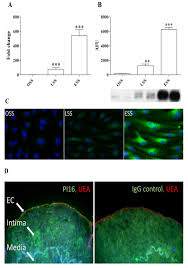 Mx vs atv all out igg : Pdf Pi16 Is A Shear Stress And Inflammation Regulated Inhibitor Of Mmp2