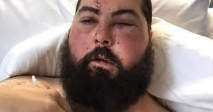 Man suffered severe facial injuries after car hit him