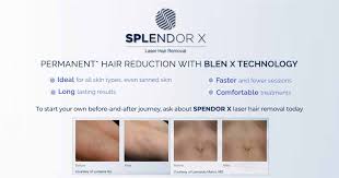 Laser hair removal cost by body area, laser hair removal pricing chart, nationwide network of hair removal specialists, tips for finding the best laser this means that laser hair removal prices in new york are not exactly the same as treatment costs in atlanta. Laser Hair Removal Brooklyn Ny Painless Laser Hair Reduction