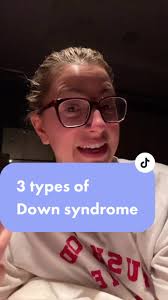 Justine Down Syndrome