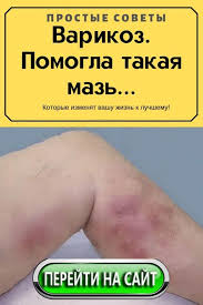 чем лечить варикозное расширение вен на ногах в домашних условиях Pin Na Doske Uhod Za Kozhej