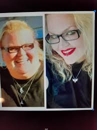 Advice for gastric sleeve surgery?