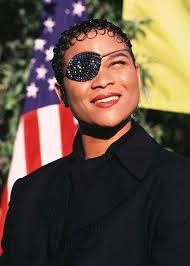 What happened to singer Gabrielle's eye?