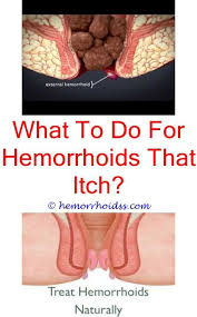 How To Use Collinsonia Root To Help Hemorrhoids Hemorrhoids Treatment Bleeding Hemorrhoids Hemorrhoids
