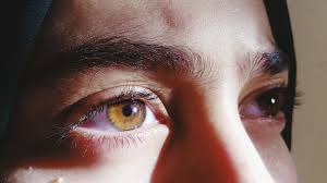 Is Crossing Your Eyes Bad For You?