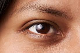 Normally your cornea, the clear outer lens or windshield of the eye, has a dome shape, like a ball.sometimes the structure isn't strong enough to hold its round shape and it bulges outward. Astigmatism Essentials Coopervision