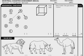 The clock drawing test is a cognitive screening tool gaining popularity in the perioperative setting. Trump Says He Aced A Cognitive Test What Does That Really Mean The New York Times