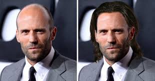 Il celebre attore diventato famoso per il musical grease e per i numerosi film di successo del suo curriculum ha dichiarato al saturday night show di essersi . Sotto Il Fotoritocco Niente I Calvi Di Hollywood Con I Capelli La Repubblica