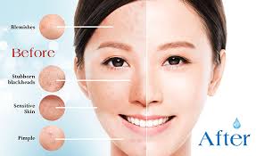 Best Facial In Singapore