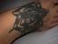 Staph Infection After Tattoo
