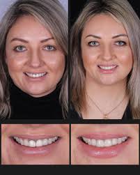 Traumatic experiences with school dental services in New Zealand