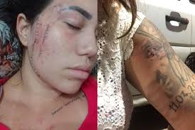 Blogueira conta detalhes após ser agredida pelo ex-namorado; mulher recebeu  100 pontos no rosto