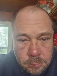 1 year drug free. Thank you Jesus and " The House Of Miracles "