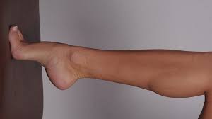 You'd be increasing the size of your lower leg below what people think of as the calf. Lower Leg Calf And Ankle Sculpting Greg Pataki M D Plastic Surgeon