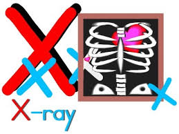 alphabet letter x x ray theme preschool lesson plan printable activities and worksheets