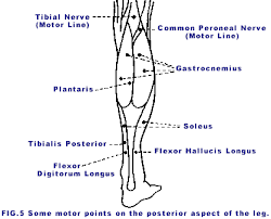 50 Cogent Muscle Motor Point Chart