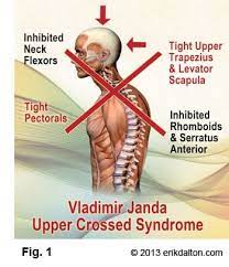 Janda Upper Crossed Neck Shoulder And Rotator Cuff Pain