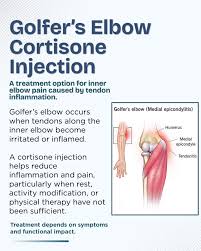 Image result for Elbow Injection
