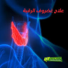 علاج غضروف الرقبة Neon Signs Poster Movie Posters
