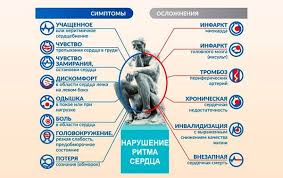 Aritmiya Serdca Kak Snyat Pristup Pervaya Pomosh Chto Delat V Domashnih Usloviyah Simptomy Lechenie Korall