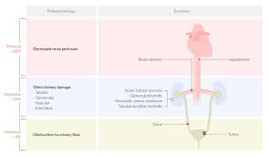 In this case, toxins begin to build up in the body and a series of symptoms will occur.hign creatinine can causes renal failure.without. Acute Kidney Injury Amboss