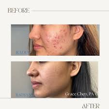 ✨Radiant Dermatology & Aesthetics✨ (@radiantderm) · Instagram 照片和视频