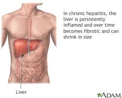 Hepatitis b vaccine is safe and effective but should not be seen as an alternative to a strategy of prevention of transmission. Hepatitis B Symptoms And Causes