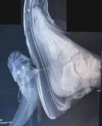 член рентген  смешные картинки, мемы и приколы на JoyReactor