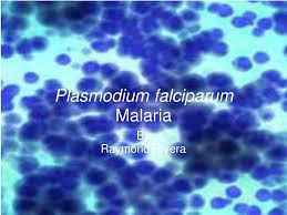 Following the first global effort to map plasmodium falciparum malaria endemicity in 2007, this paper describes the generation of a new world map for the year annual parasite incidence data for 13,449 administrative units in 43 endemic countries were sourced to define the spatial limits of p. Ppt Plasmodium Falciparum Malaria Powerpoint Presentation Free Download Id 3139404