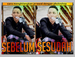 Photoshop menjadi penolong andalan untuk menghilangkan jerawat seketika. Tutorial Cara Menghilangkan Jerawat Di Photoshop Halaman 1 Kompasiana Com