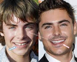 Chris funderburk, said that zac. Zac Efron Before And After 2020