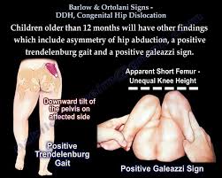 Image result for Succussion Splash