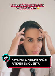 Alopecia Androgenética: Primer Signo y Evaluación