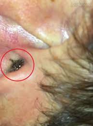 Kết quả hình ảnh cho hình ảnh nhện