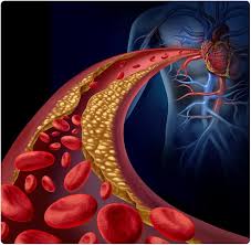 Bleeding and blood clotting, escape of blood from blood vessels into surrounding tissue and the process of coagulation through the action of platelets. Blood Clotting Process