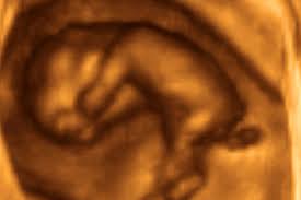 Ab wann wird der ultraschall über den bauch gemacht ? 6 Schwangerschaftswoche 6 Ssw Alle Infos Eltern De